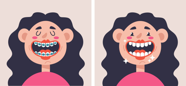 支架系统前后概念。矢量平面平面设计卡通插图图片下载