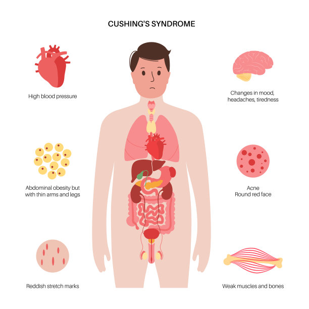 库欣疾病海报图片下载