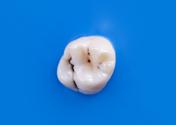 有深洞的牙齿，图为开始治疗前的照片图片下载