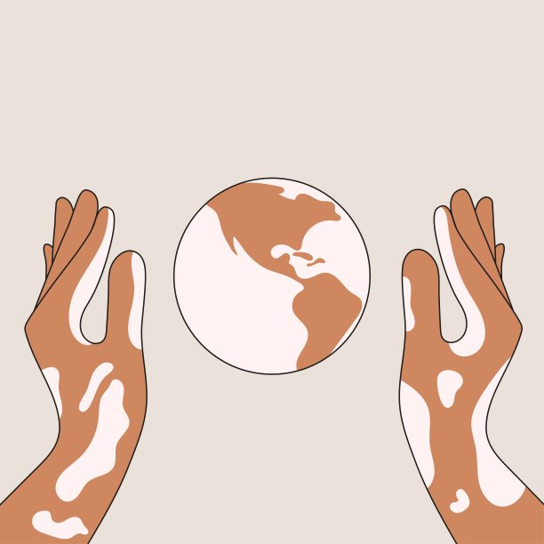 一个患有白癜风皮肤病的人的手小心地拿着行星平面矢量插图图片下载