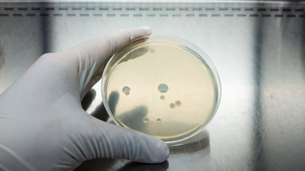 近距离拍摄，在微生物实验室的层流或BSC类II柜中手持培养皿。图片下载