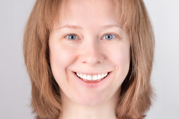 口腔清洁，牙齿美白，个人口腔卫生，健康的牙龈，妇女微笑后漂白牙齿间隙在牙齿矫正诊所牙医图片下载