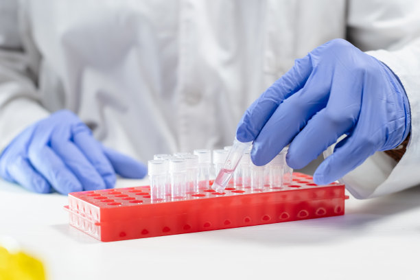 医务人员从盒盘中取出装有透明液体的样管图片下载