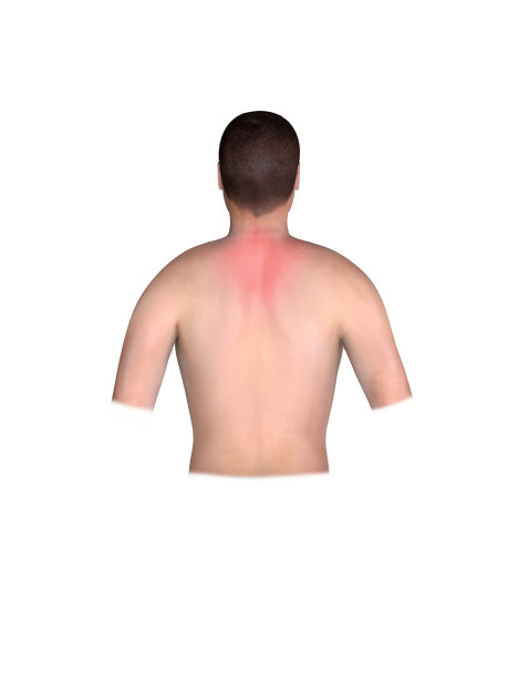 心脏病发作部位在背部，心脏病发作时胸痛。医学插画3d图形，心脏病发作区，心电图图片下载