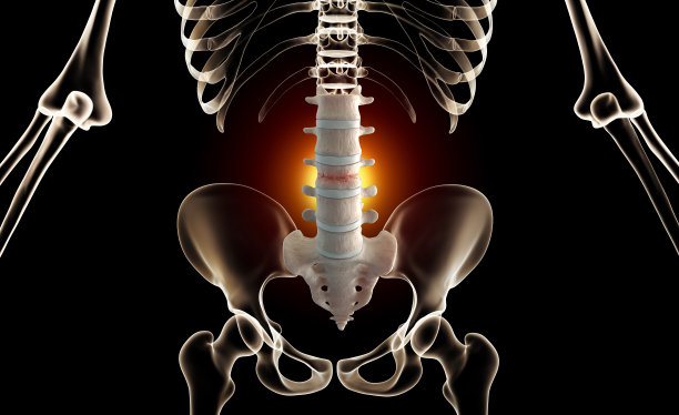 腰椎压缩骨折图片下载