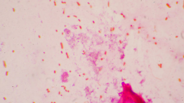 细菌细胞革兰氏阴性杆菌与胶囊病原体。革兰氏染色法取痰标本。图片下载