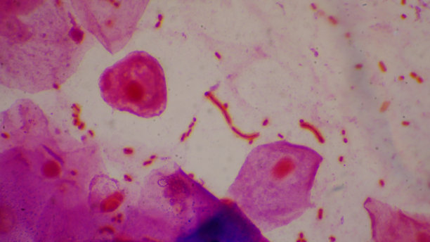 细菌细胞革兰氏阴性杆菌与胶囊病原体。革兰氏染色法取痰标本。图片下载