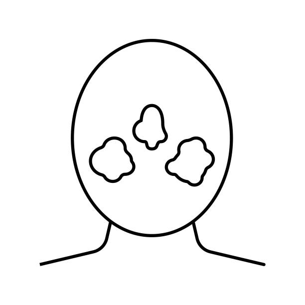 酒渣鼻皮肤病线图标矢量插图图片下载