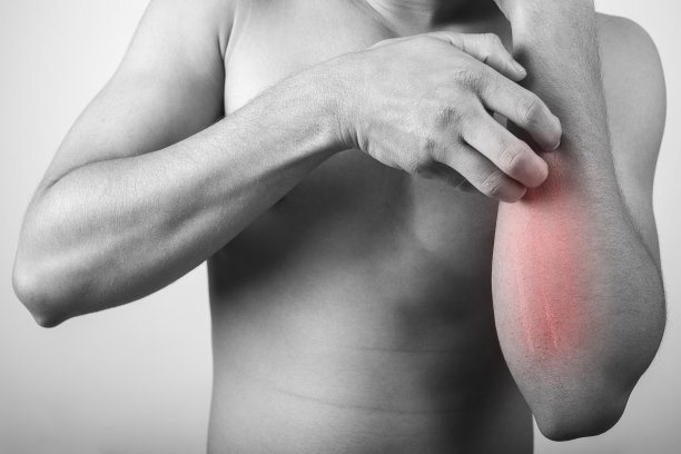 男子前臂皮肤瘙痒，因皮肤过敏问题图片下载