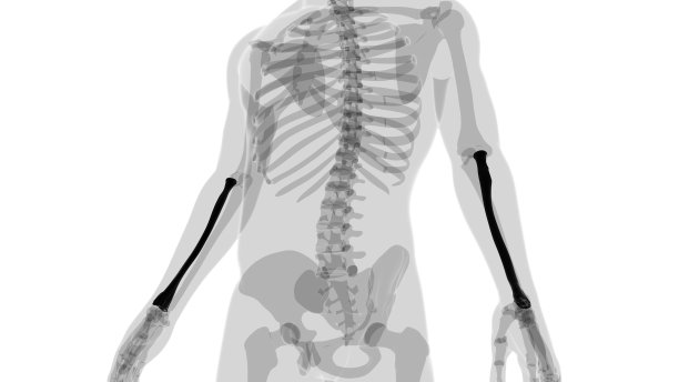 人体骨骼解剖桡骨三维绘制图片下载