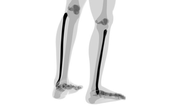 人体骨骼解剖腓骨三维渲染图片下载