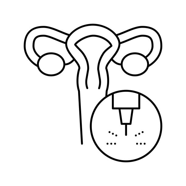 子宫医疗激光治疗线图标矢量插图图片下载