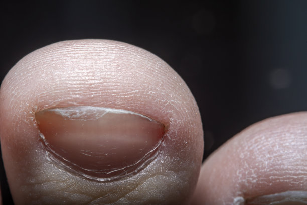 脚趾与指甲的特写。指尖的小细节。照片在软聚焦在高倍放大。图片下载