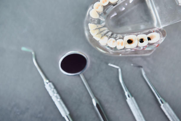 牙齿模型与牙齿工具。牙科和牙齿健康的概念。图片下载