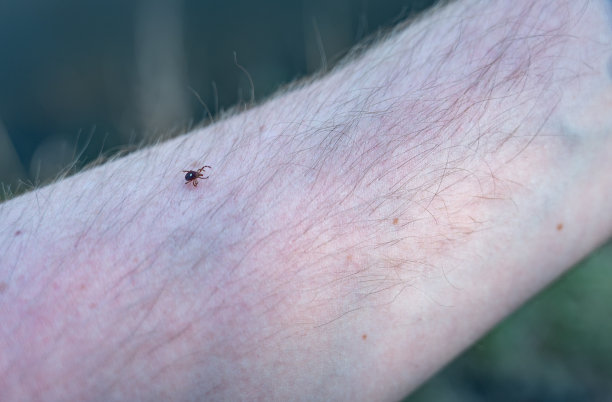 孤星蜱在人类皮肤上的手臂毛里爬行图片下载