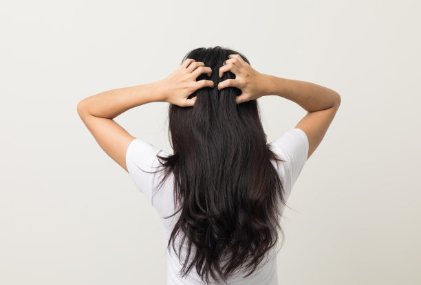 年轻女子头部发痒头皮上有一种真菌头皮屑，红疹子她挠挠头来缓解。需要看医生。头发问题脱发。在孤立的背景下拍摄图片下载