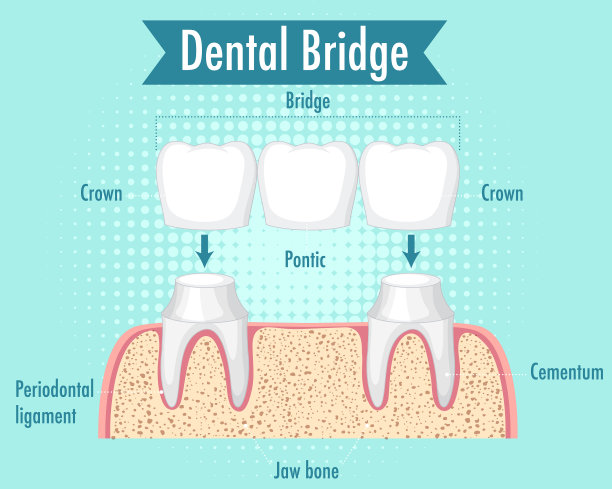 人牙桥的资讯图图片下载