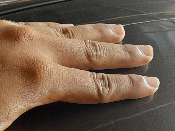 人类的手指图片下载