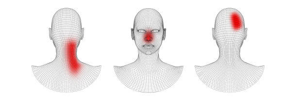 成人背部疼痛病。颈部健康女性医学插图。年轻女性的医学观念。患有流感和头痛的妇女过敏问题或寒冷设计。矢量图图片下载