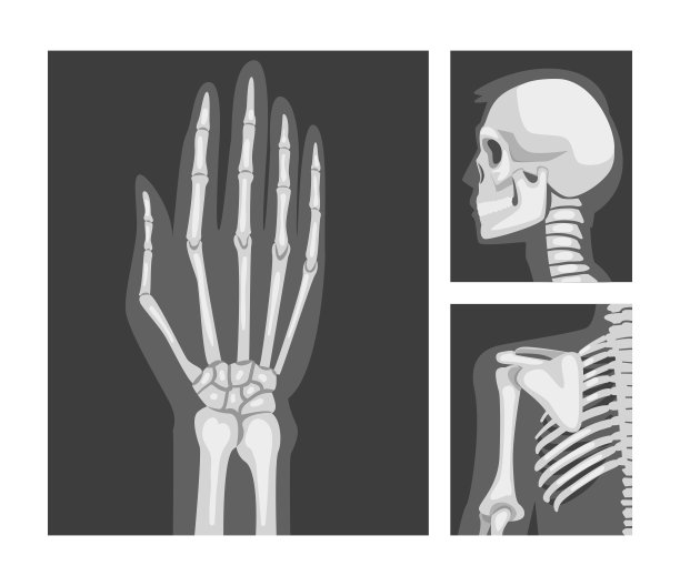 人体x线影像头、手、肩骨向量集图片下载