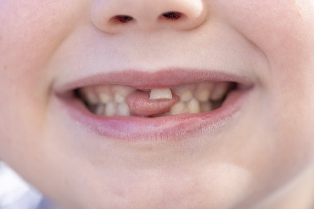 失去的牙齿图片下载