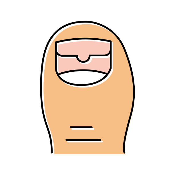 奥氏体甲病颜色图标矢量插图图片下载