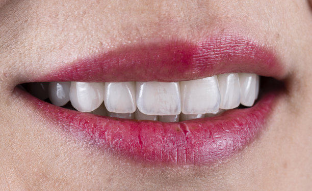 陶瓷冠饰面b3色图片下载