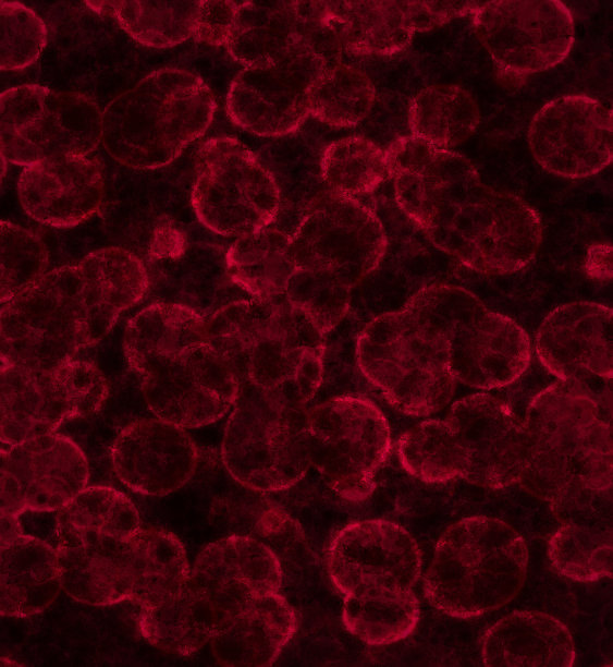 血液感染特写。显微镜下的感染细胞。血液中的病毒图片下载