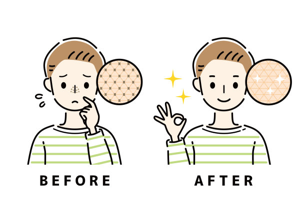 一个治愈了黑鼻子的人。图片下载