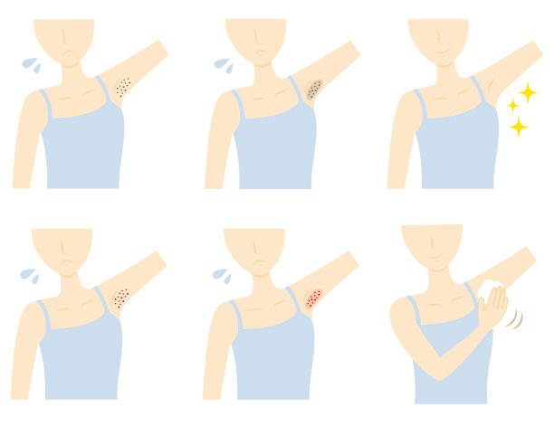 女性腋下皮肤问题集图片下载