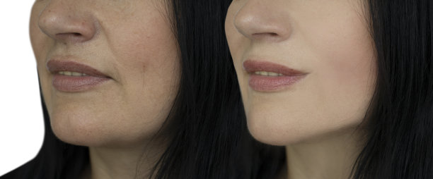 女人脸上的皱纹前后不同图片下载
