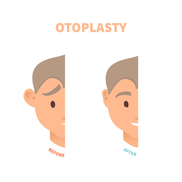 男子耳成形术前后进行耳部手术治疗图片下载