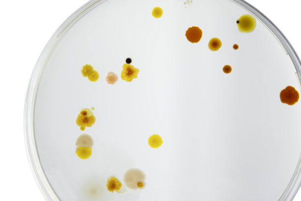 无菌培养皿和培养基与细菌在白色背景下剪切，检测各种细菌、病毒、冠状病毒、冠状病毒、COVID-19、微生物种群计数。食品科学。图片下载