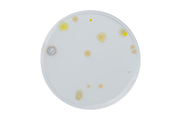 无菌培养皿和培养基与细菌在白色背景下剪切，检测各种细菌、病毒、冠状病毒、冠状病毒、COVID-19、微生物种群计数。食品科学。图片下载