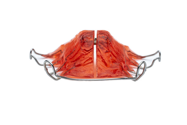 可拆卸的金属丝腭扩张器在白色背景。口腔正畸治疗。口腔保健理念。图片下载