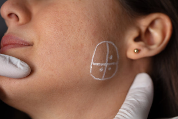 注射到脸部的下巴区域。美学、医学概念。青年注射。图片下载