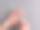 有皮肤病(湿疹、荨麻疹、皮炎、红斑、水泡或感染)的妇女手涂霜。图片下载