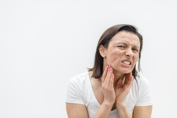 照片上的女人有皮肤问题，感觉很糟糕。图片下载