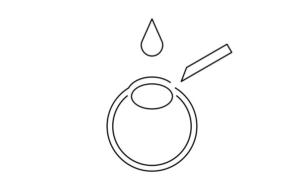 人工角膜接触镜手术及切口图图片下载