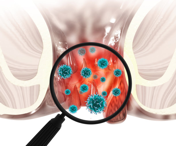 痔疮(痔疮)的科学背景。三维演示图片下载