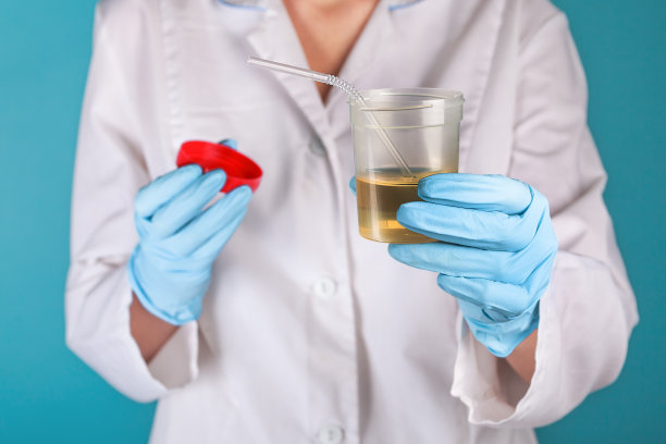 女医生的肖像，谁持有一罐尿和管作为一个想法治疗尿，是喝了。urinotherapy图片下载