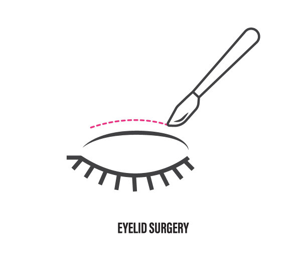 眼皮手术。矢量图标。眼睑整形手术。眼睛手术。手术面部复兴。图片下载