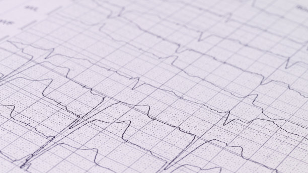 白纸上的图表用选择性聚焦接近图片下载