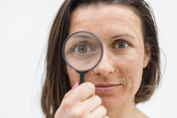 通过放大镜观察皮肤干燥的女性特写照片。图片下载