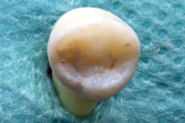 前磨牙牙齿。图片下载