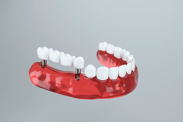 牙齿移植到颌骨的3d图像图片下载