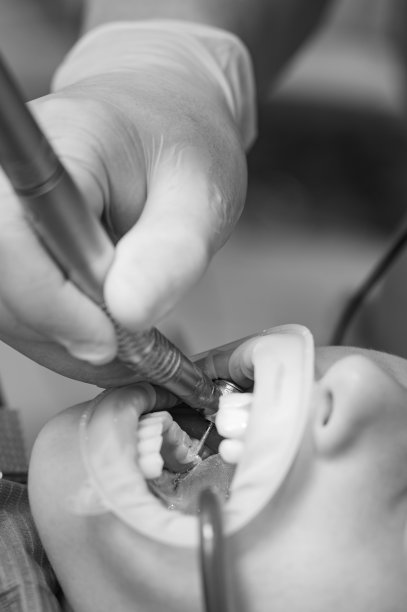 牙医用钻头清除儿童龋齿，将唾液喷射到儿童口中。图片下载