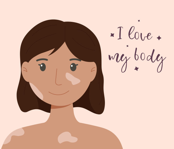 快乐女孩白癜风。世界白癜风的一天。皮肤疾病。图片下载