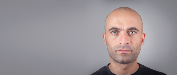 白种人的秃头。脱发的概念图片下载
