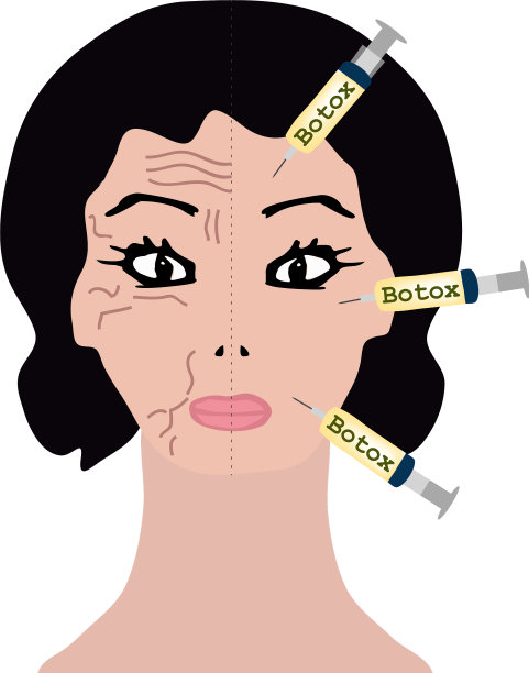 半脸皱纹肉毒杆菌素治疗图片下载